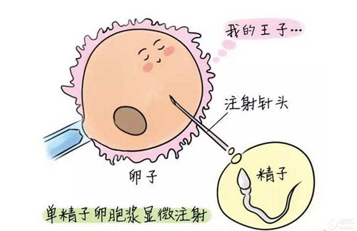 赴泰试管婴儿前预测获卵数，能为促排指明方向？